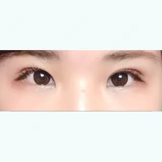 131日目の経過画像（1枚目）