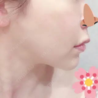 16日目の経過画像（2枚目）