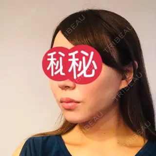 1日目の経過画像（2枚目）