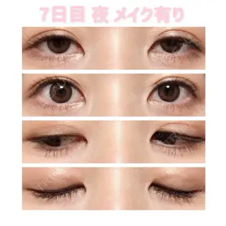 7日目の経過画像（1枚目）