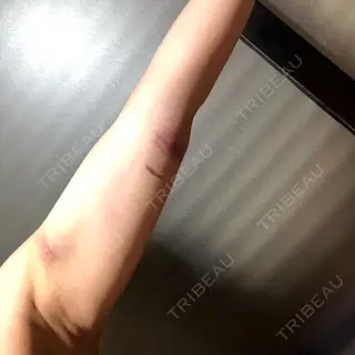 2日目の経過画像（3枚目）
