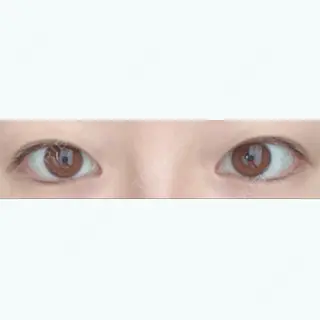 79日目の経過画像（1枚目）