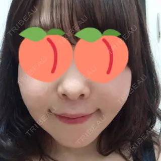 40日目の経過画像（1枚目）