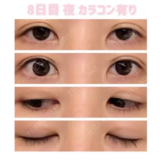 8日目の経過画像（2枚目）