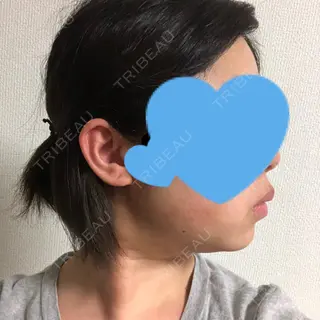12日目の経過画像（2枚目）