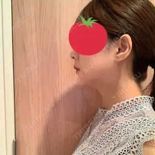 53日目の経過画像（2枚目）