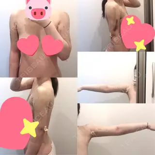 5日目の経過画像（1枚目）
