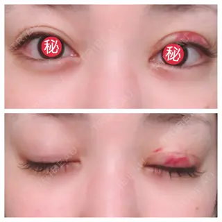 6日目の経過画像（1枚目）
