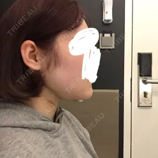 2日目の経過画像（3枚目）