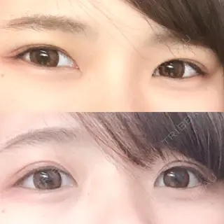 5日目の経過画像（1枚目）