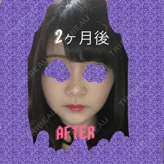 57日目の経過画像（3枚目）