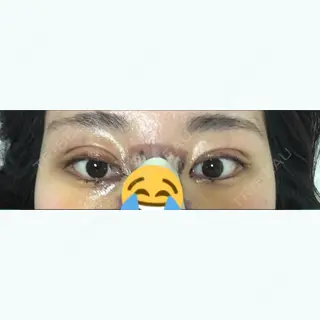 6日目の経過画像（1枚目）