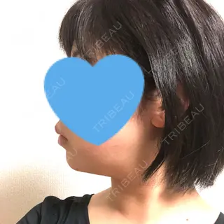 16日目の経過画像（3枚目）