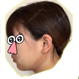 1日目の経過画像（1枚目）