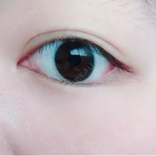 4日目の経過画像（2枚目）