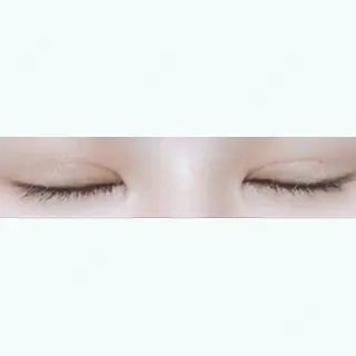4日目の経過画像（2枚目）