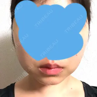18日目の経過画像（1枚目）