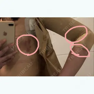 2日目の経過画像（1枚目）