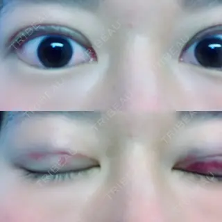 1日目の経過画像（1枚目）