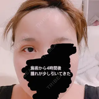 0日目の経過画像（2枚目）