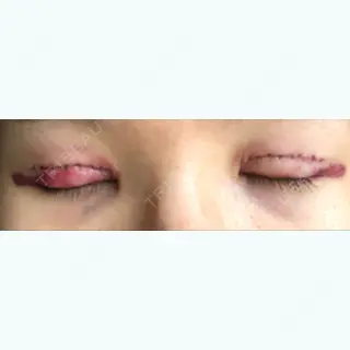 2日目の経過画像（2枚目）
