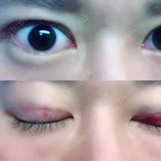 2日目の経過画像（1枚目）