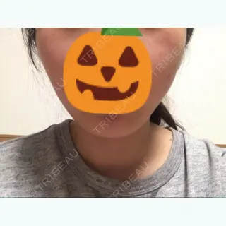 23日目の経過画像（1枚目）