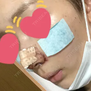 1日目の経過画像（3枚目）