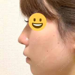 5日目の経過画像（1枚目）