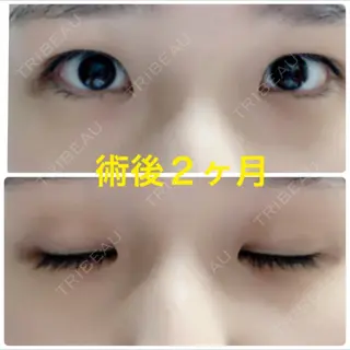 61日目の経過画像（1枚目）