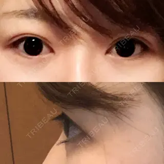 200日目の経過画像（2枚目）