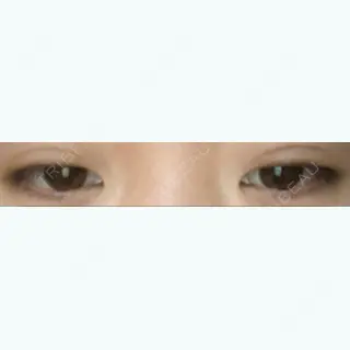 38日目の経過画像（1枚目）