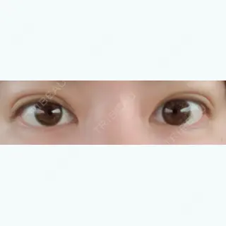 48日目の経過画像（1枚目）