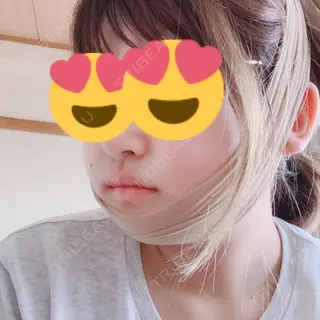 2日目の経過画像（2枚目）
