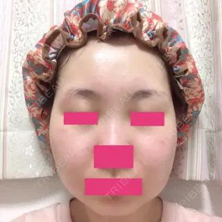 39日目の経過画像（1枚目）