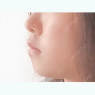 6日目の経過画像（1枚目）