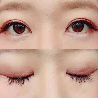 200日目の経過画像（1枚目）