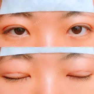 2日目の経過画像（1枚目）