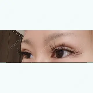 0日目の経過画像（2枚目）
