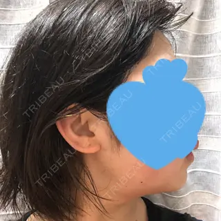 23日目の経過画像（2枚目）