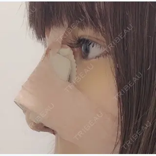 4日目の経過画像（2枚目）