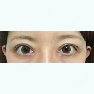 20日目の経過画像（1枚目）