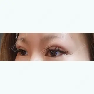 1日目の経過画像（2枚目）