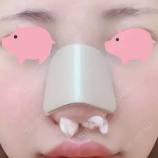 0日目の経過画像（1枚目）