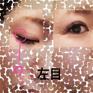 5日目の経過画像（2枚目）