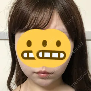 15日目の経過画像（1枚目）