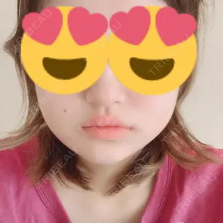 5日目の経過画像（1枚目）