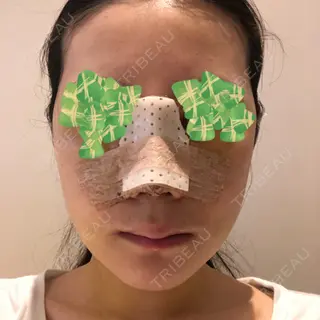 5日目の経過画像（1枚目）