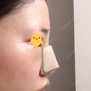 1日目の経過画像（2枚目）