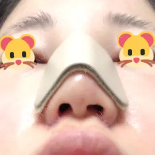 1日目の経過画像（3枚目）
